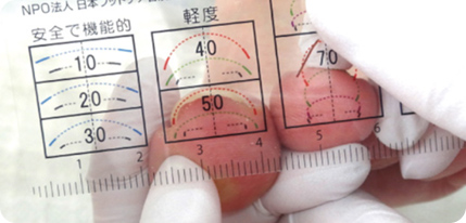 巻き爪ケアの流れ2〜巻き爪の度合いの評価〜