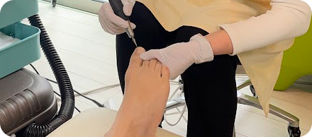 巻き爪治療の特長4